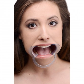 CHEEK RETRACTOR DENTAL - MOUTH GAG