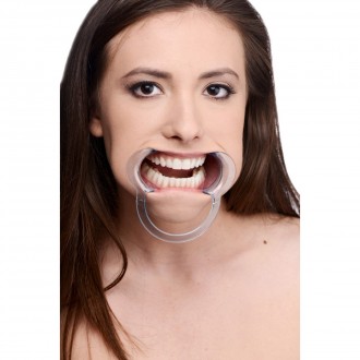 CHEEK RETRACTOR DENTAL - MOUTH GAG